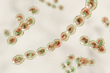 오른쪽아랫배통증