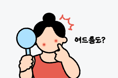 다낭성난소증후군여드름