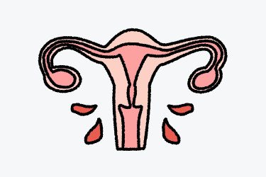 자궁경부이형성증_증상