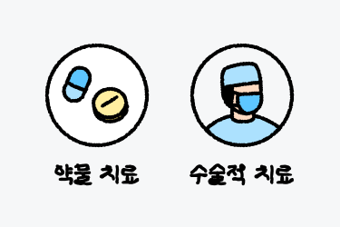 난소낭종, 치료방법